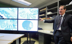 200 To pour une image du cerveau humain : le big data en neurosciences